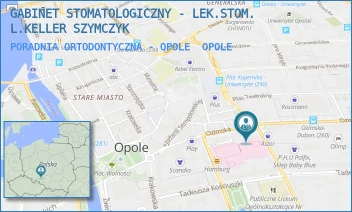 PORADNIA ORTODONTYCZNA - OPOLE - GABINET STOMATOLOGICZNY - LEK.STOM. L.KELLER SZYMCZYK - UL. OZIMSKA 20/212,  OPOLE
